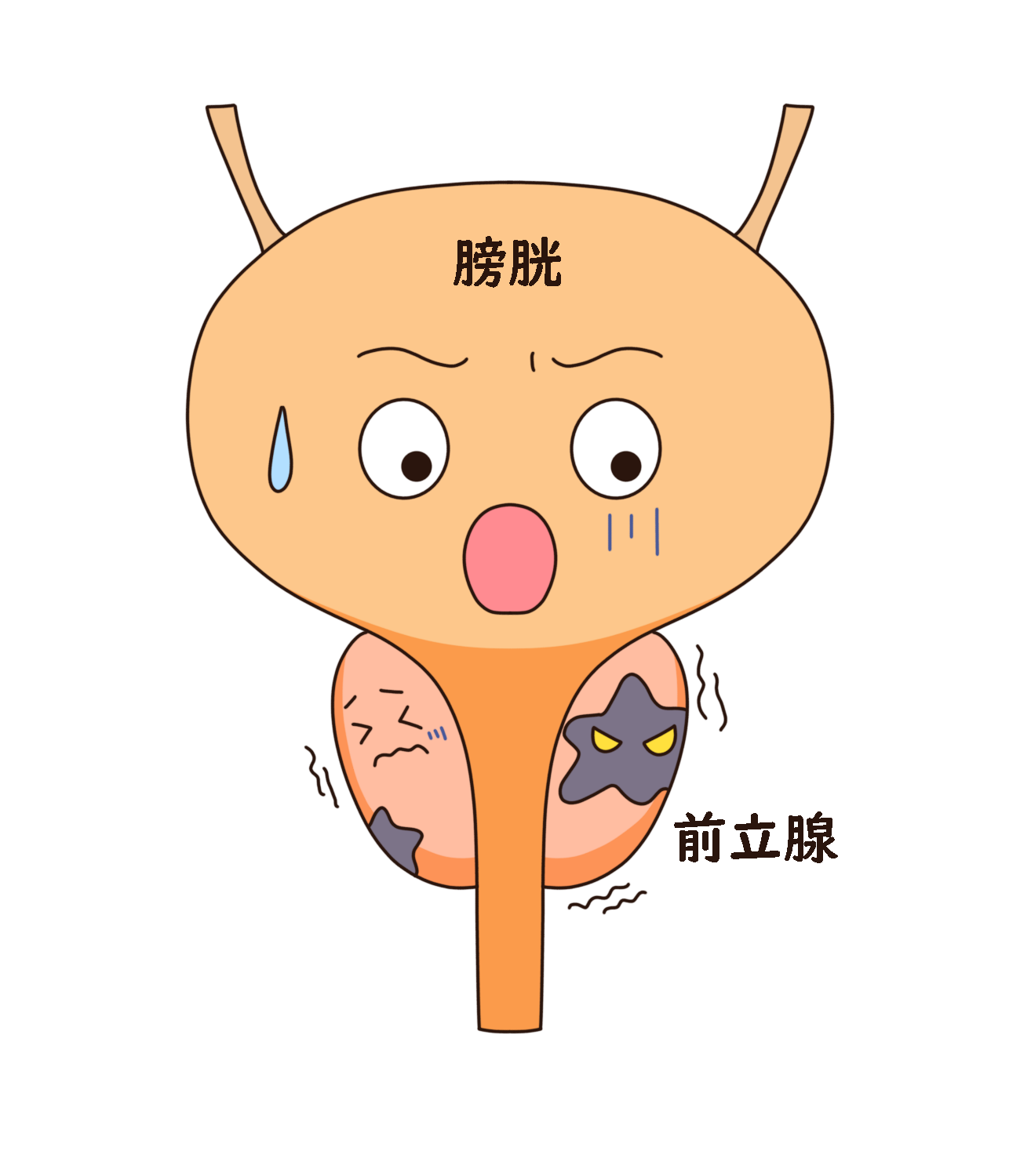 日帰り前立腺針生検